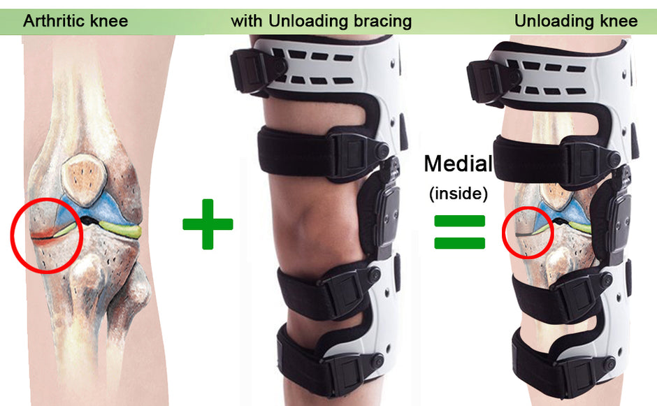 OA Unloader Knee Brace – Orthomen